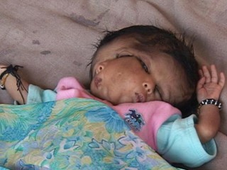 Baby Born With 2 Faces In North India Villagers Worship Her As A Goddess